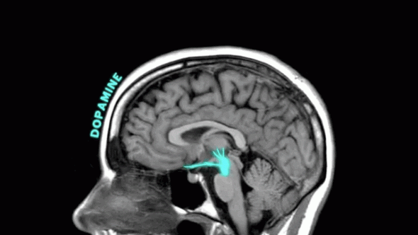 4. V období zamilovanosti vytváří lidský mozek stejné neurotransmitery a hormony, jaké vznikají při užívání amfetaminů.